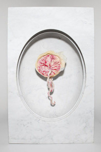 Contemporary art of marble encased plastinated placenta shows the life giving and life taking qualities of this organ.